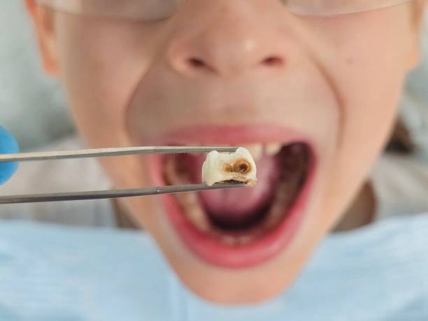 Best Emergency Care for Gum Disease in Stevenson, AL