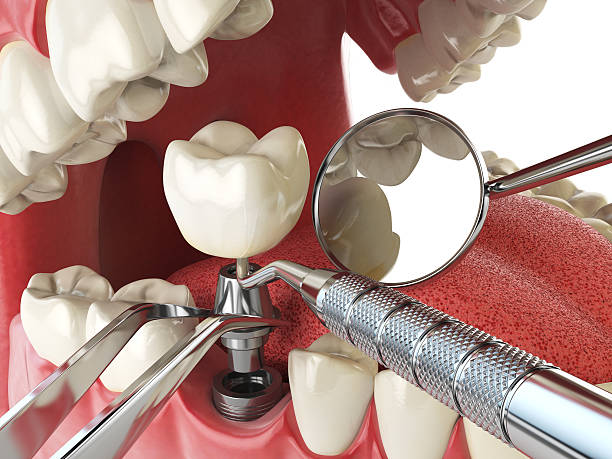 Best Emergency Treatment for Oral Infections in Stevenson, AL